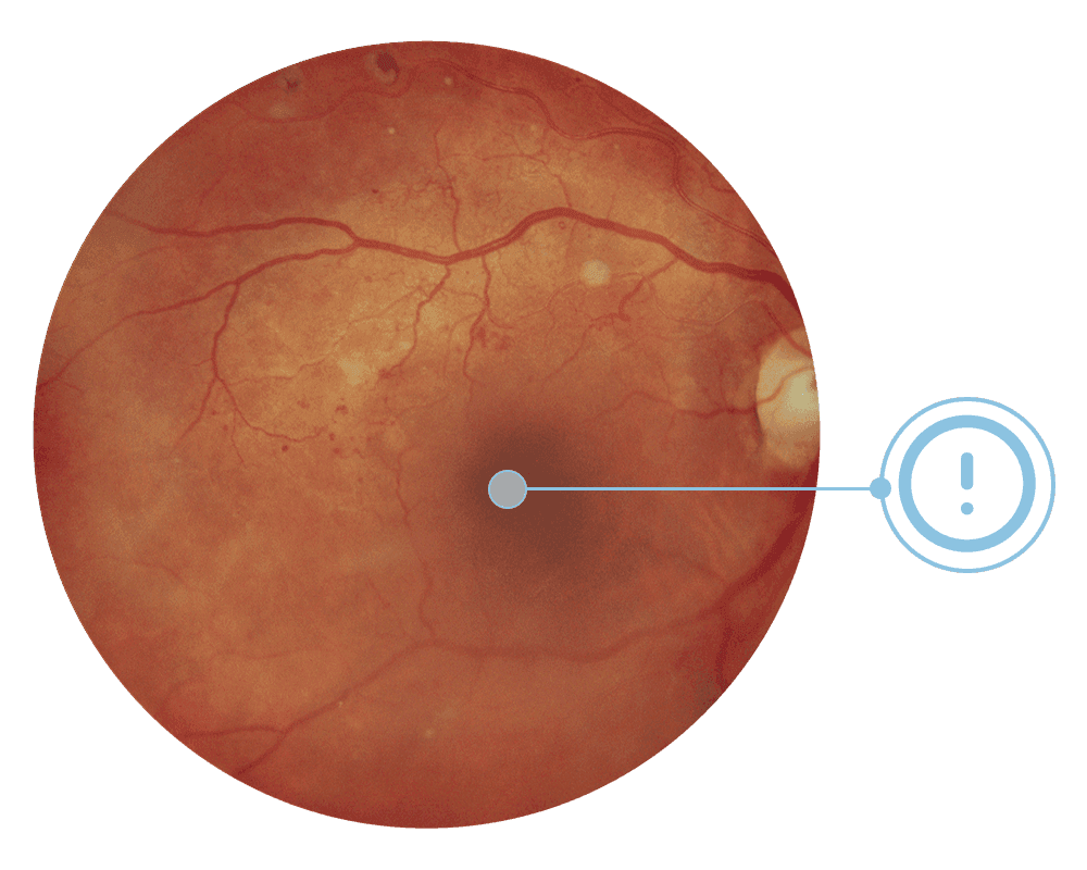 optometry exam